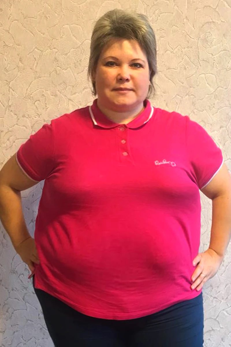 Ирина Галкина до похудения в центре снижения веса