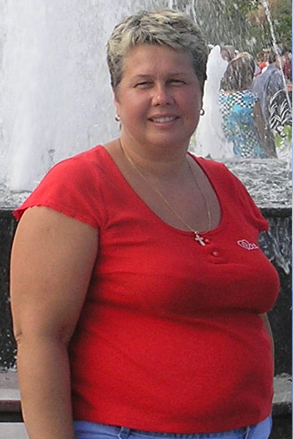 Вера Косова до похудения в центре снижения веса