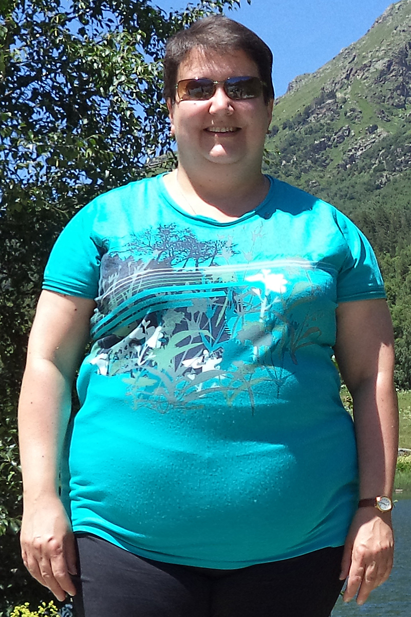 Ольга Никитина до похудения в центре снижения веса
