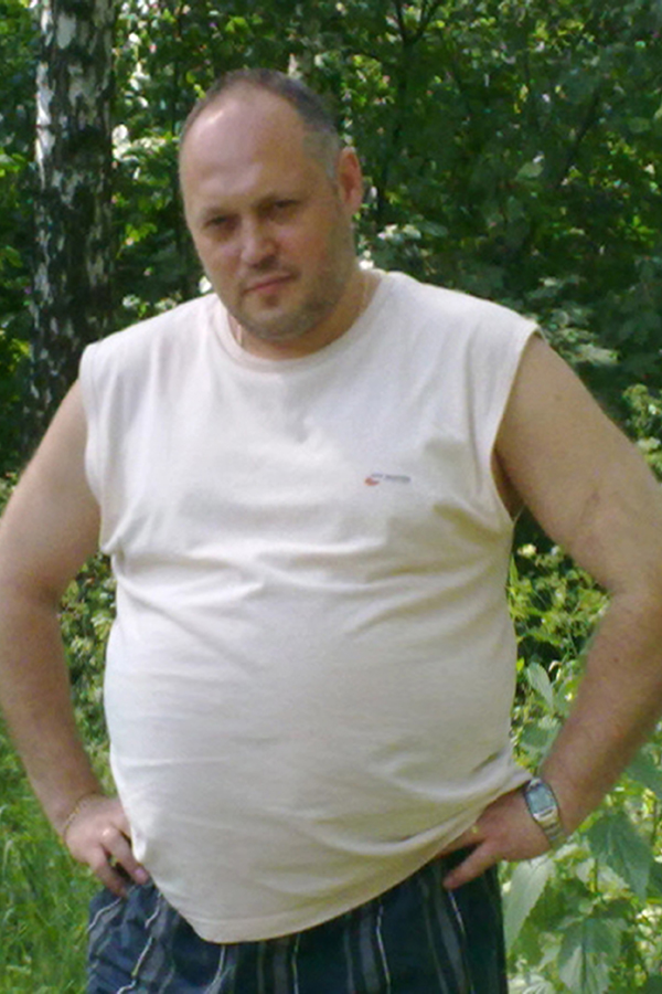Владимир Зиновьев до похудения в центре снижения веса